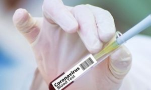 pracownik testy koronawirus badanie krwi firma pracodawca