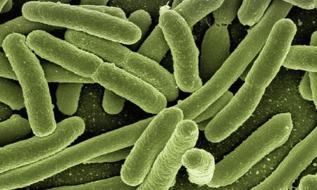 rzeszów bakteria legionella zakażenia