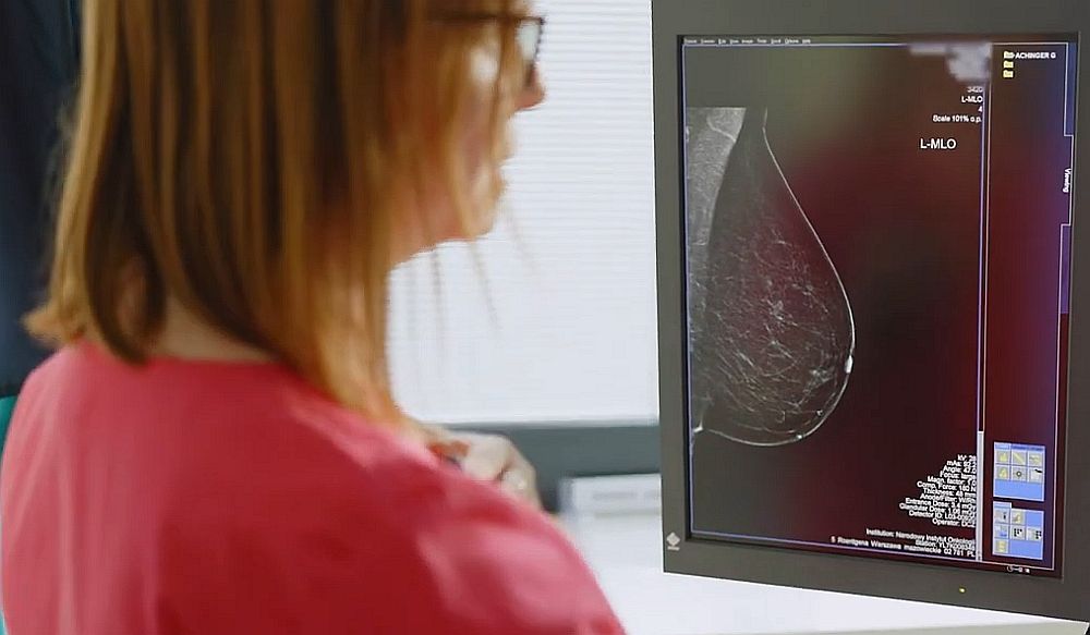 bezpłatna mammografia 2023
